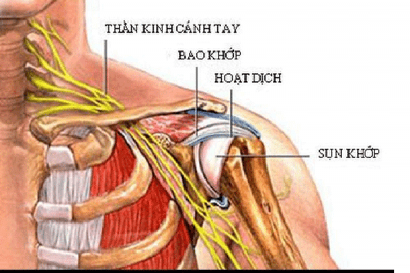 Nguyên nhân của bệnh thoái hóa khớp vai 