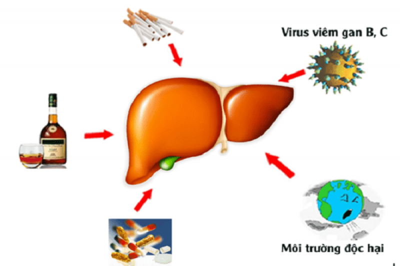 Những nguyên nhân gây ra bệnh viêm gan C là gì Những nguyên nhân gây ra bệnh viêm gan C là gì