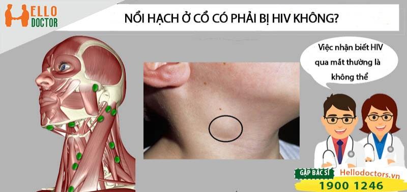 Nổi hạch ở cổ có phải bị HIV không, làm sao để nhận biết?