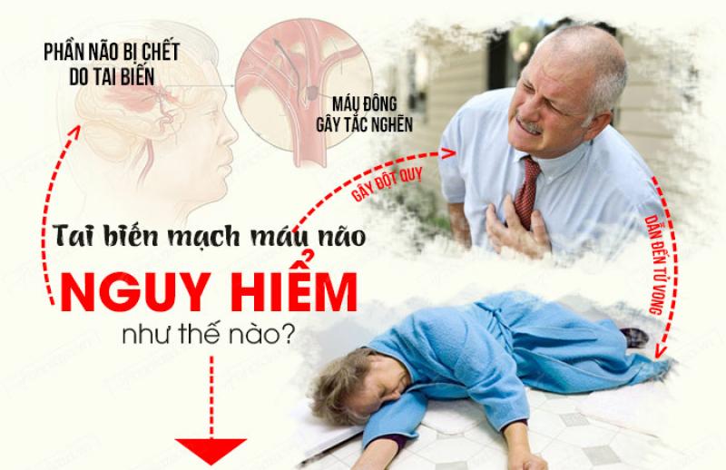 Phác đồ điều trị tai biến mạch máu não Phác đồ điều trị tai biến mạch máu não
