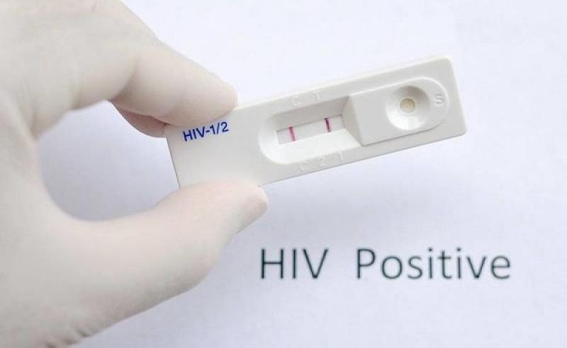 Phải làm gì sau khi được chẩn đoán bị dương tính với HIV? Phải làm gì sau khi được chẩn đoán bị dương tính với HIV?