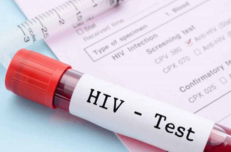 Phơi nhiễm HIV là gì, cách xử lý khi bị phơi nhiễm?
