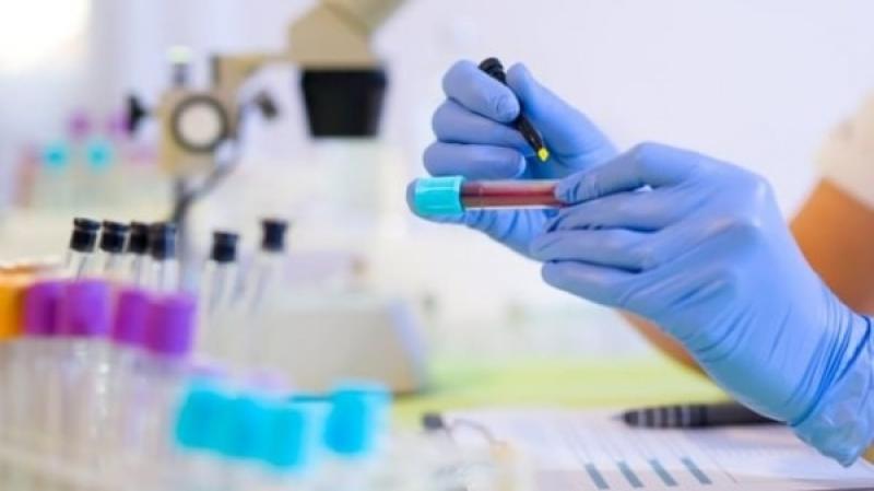 Protein trong máu cao có nguy hiểm không? Protein trong máu cao có nguy hiểm không?