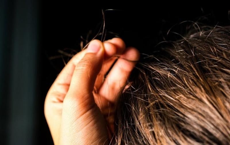Rối loạn kéo tóc