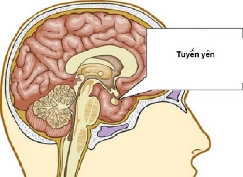 Suy tuyến yên Suy tuyến yên