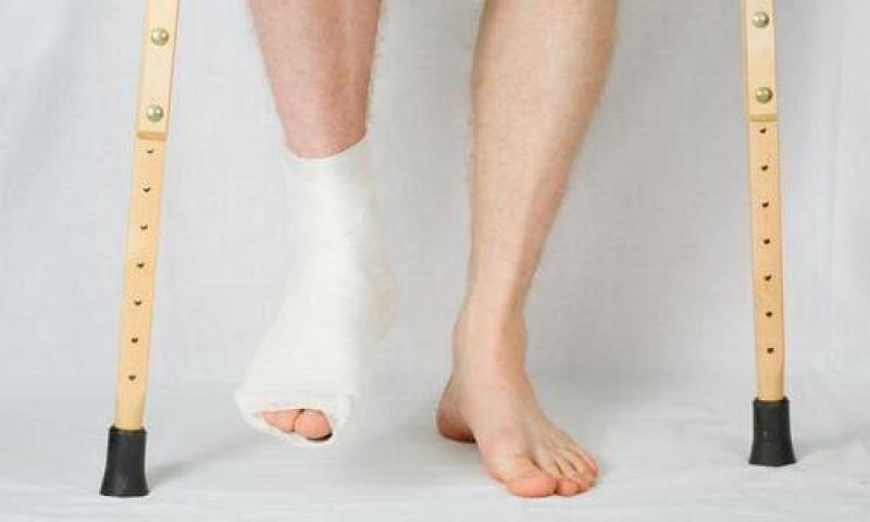 Teo cơ chân sau bó bột