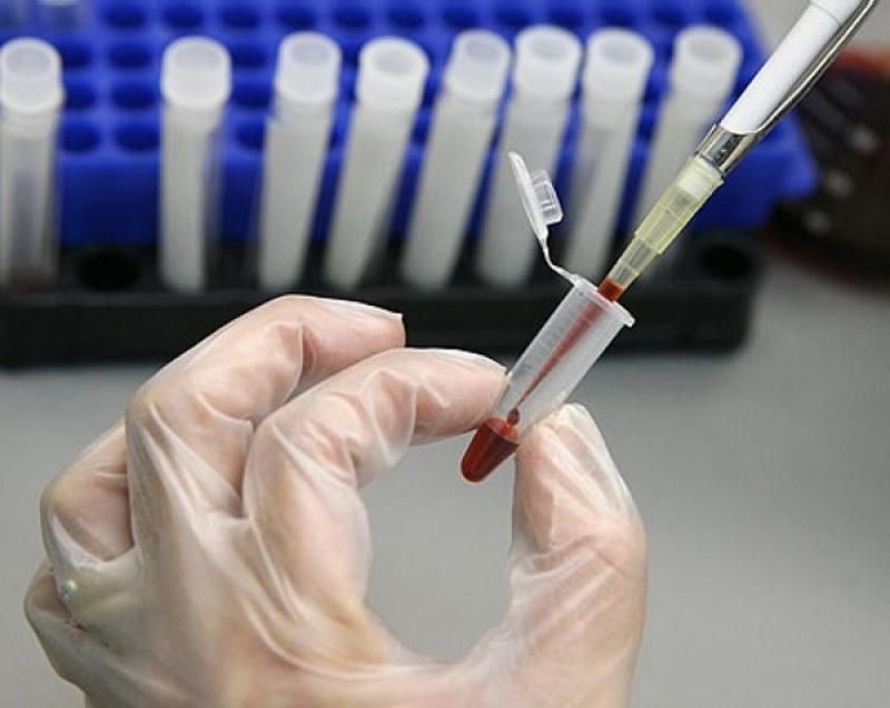 Thời gian có thể xét nghiệm phơi nhiễm hiv là bao lâu?