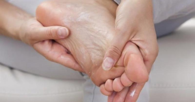 Tình trạng lột da tay, chân Peeling skin