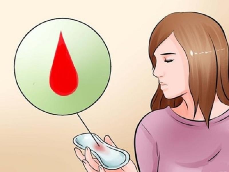 Tôi bị chảy máu âm đạo là do nguyên nhân gì?