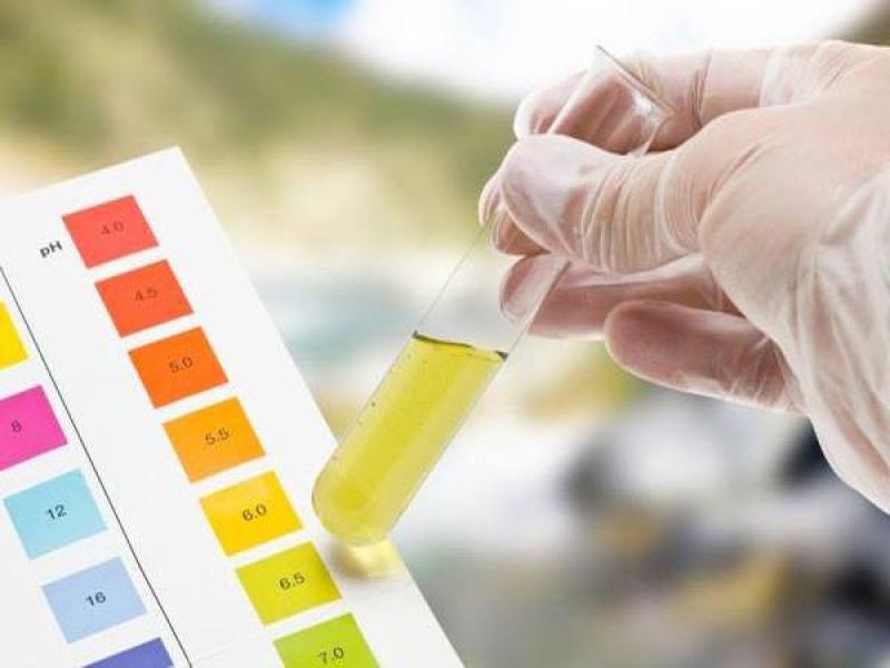 Triệu chứng Protein niệu là dấu hiệu của bệnh gì?