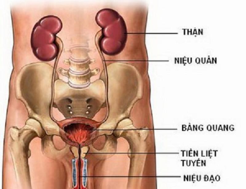 Ung thư niệu quản