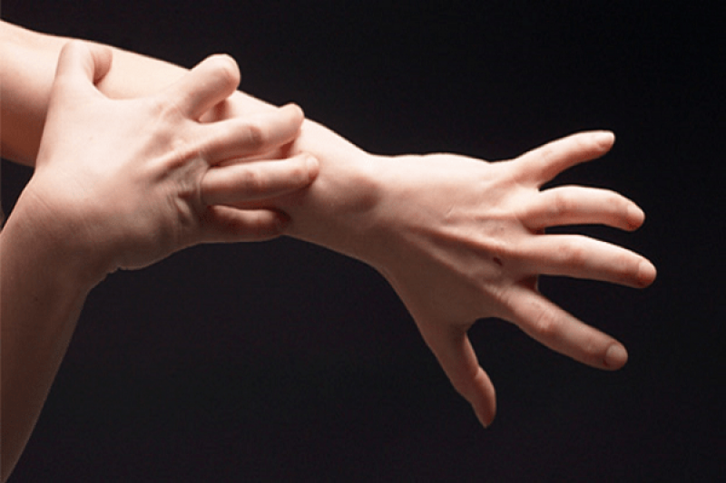 Vì sao tôi bị ngứa và phải chữa trị như thế nào