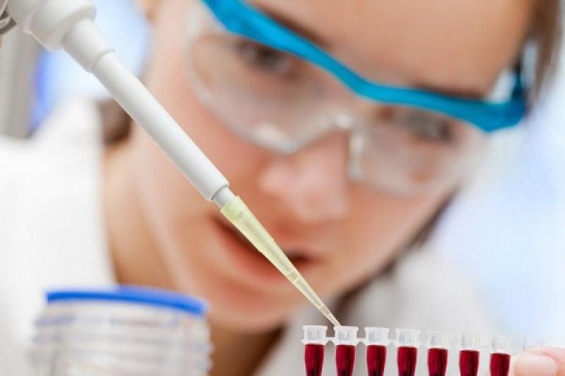 Phương pháp xét nghiệm HIV ag-ab combo là gì? Có chính xác không?