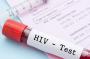 Hội chứng suy giảm miễn dịch mắc phải ở người - nhiễm HIV
