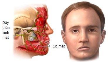 Co giật cơ mặt liên tục
