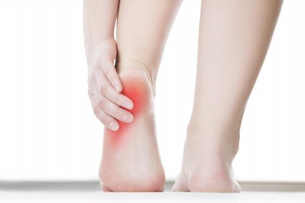Có thể chữa dứt điểm đau gót chân được không?