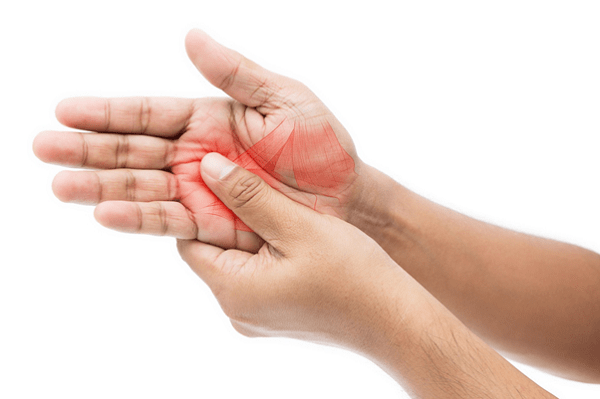 Đau dây thần kinh cánh tay