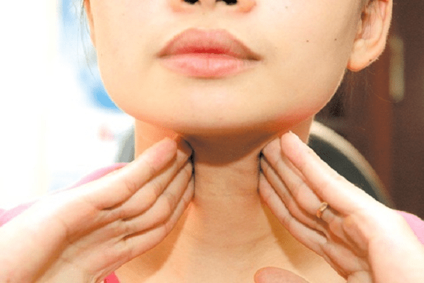 Dấu hiệu, biểu hiện và triệu chứng của bệnh suy giáp