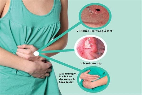 Dấu hiệu và triệu chứng của bệnh viêm loét dạ dày tá tràng