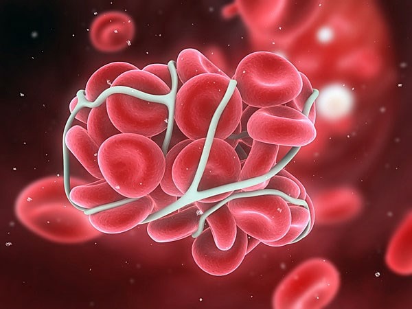 Có những triệu chứng nào cho thấy sự tăng hồng cầu trong cơ thể?
