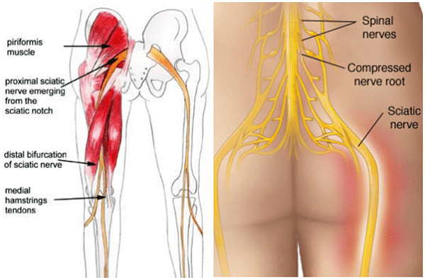 Đau Mông Phải Là Bệnh Gì? Nguyên Nhân, Triệu Chứng và Giải Pháp Hiệu Quả