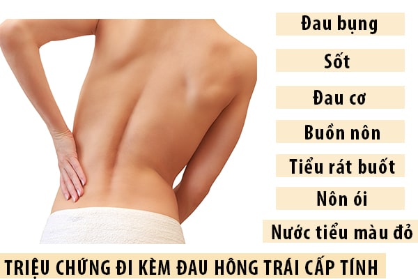 Các triệu chứng có thể đi kèm đau hông trái cấp tính