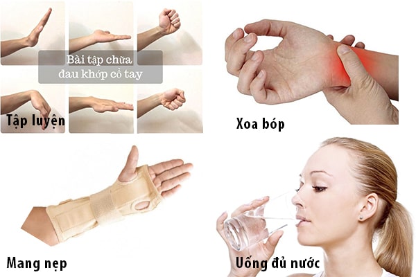 Một só cách tự điều trị khắc phục Hội chứng ống cổ tay
