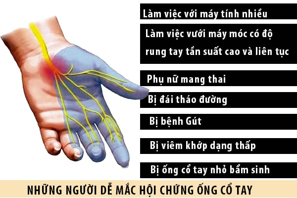Những người dễ bị mắc hội chứng ống cổ tay