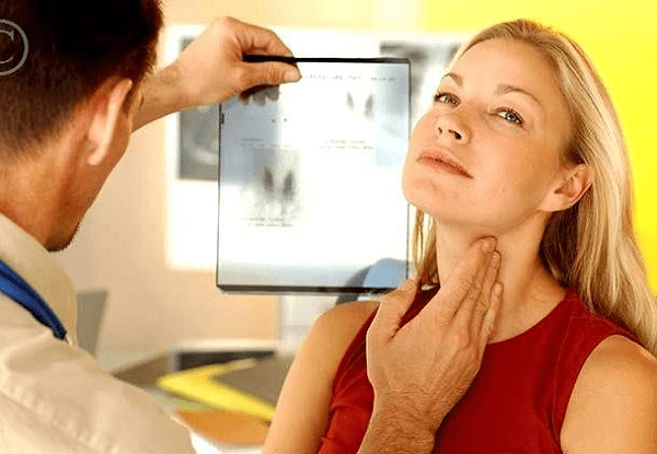 Điều trị bệnh bướu cổ
