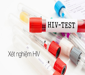 Xét nghiệm HIV giúp phát hiện bệnh HIV chính xác nhất
