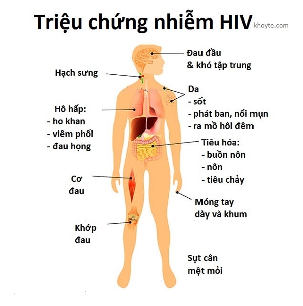 Bệnh HIV giai đoạn đầu - triệu chứng, cách chẩn đoán và điều trị