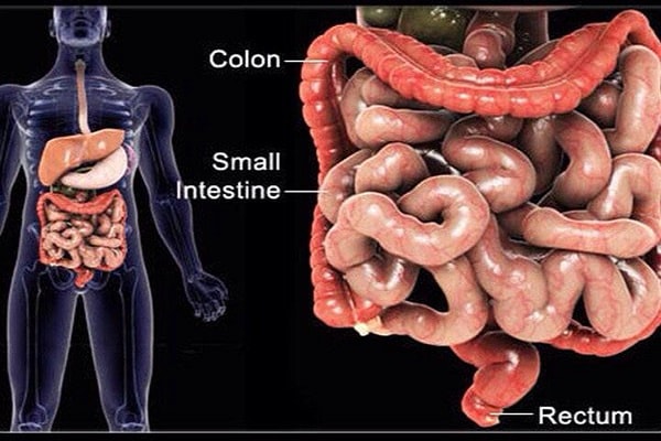 Điều trị bệnh viêm ruột Crohn