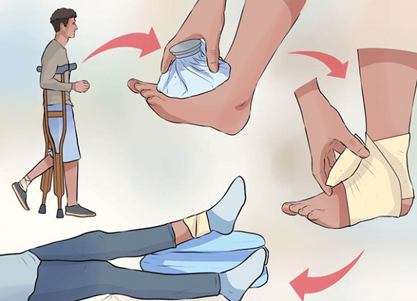 Biện pháp chăm sóc khi bị đau cổ chân
