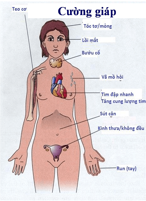 Chẩn đoán bệnh Cường Giáp Basedow