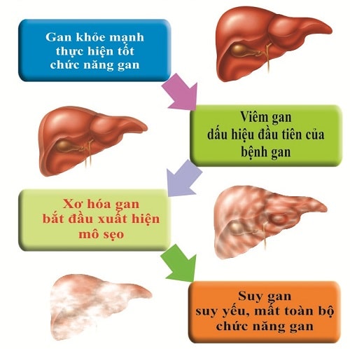 Tổng Quan về Bệnh Viêm Gan B