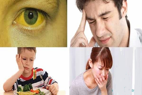 triệu chứng bệnh viêm gan C