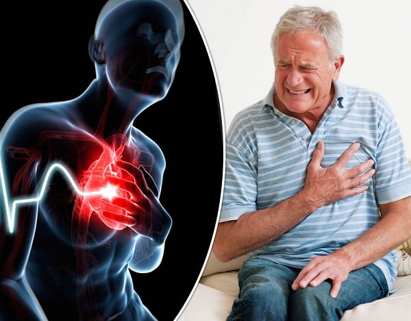 Biểu hiện của đau ngực Biểu hiện của triệu chứng đau ngực
