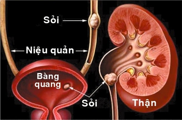 Tổng quan về hệ tiết niệu