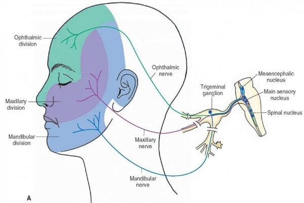Nguyên nhân của bệnh đau dây thần kinh số V