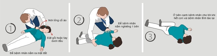 Cách sơ cứu người bị co giật