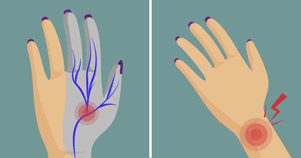 Nguyên nhân gây ra triệu chứng tê đầu ngón tay