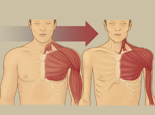 nguyên nhân gây teo cơ delta