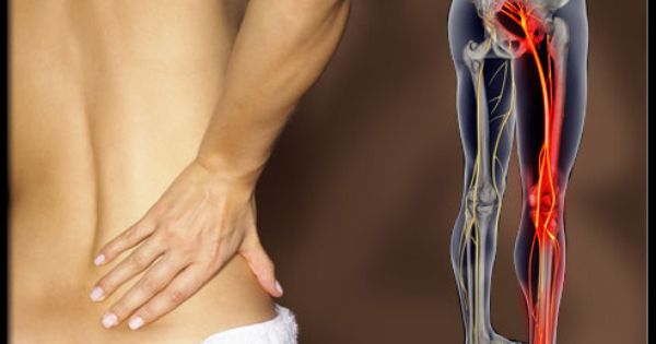 Không nên xem nhẹ bệnh đau dây thần kinh liên sườn