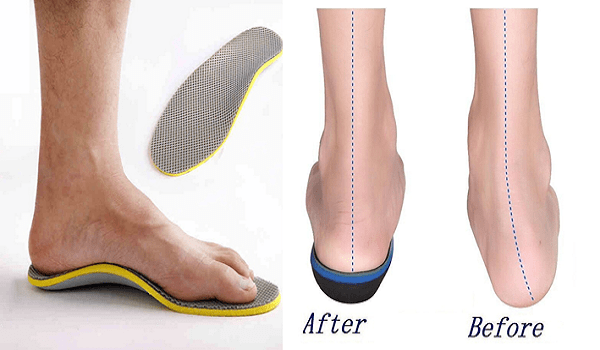 Điều trị đau lòng bàn chân