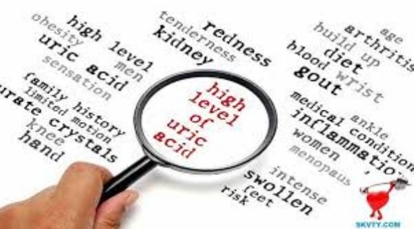Triệu chứng nồng độ axit uric cao