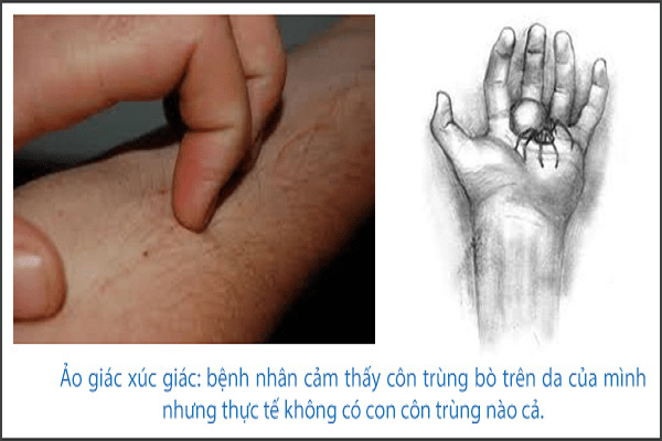 Ảo giác xúc giác Ảo giác xúc giác