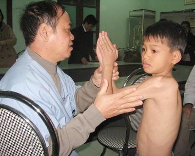 Phẫu thuật teo cơ Delta