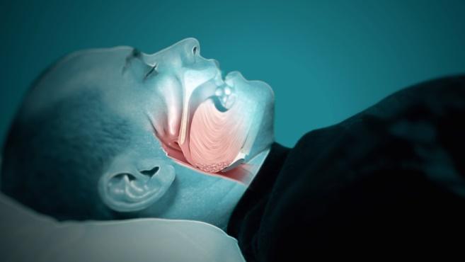 rối loạn giấc ngủ ở người lớn