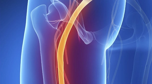 Nguyên nhân gây ra tê bắp chân