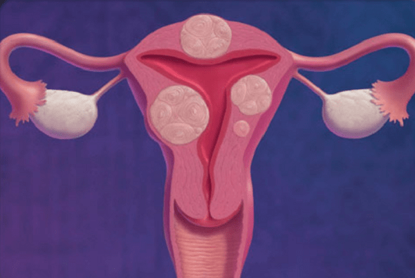 Nguyên nhân gây ra đau hạ vị